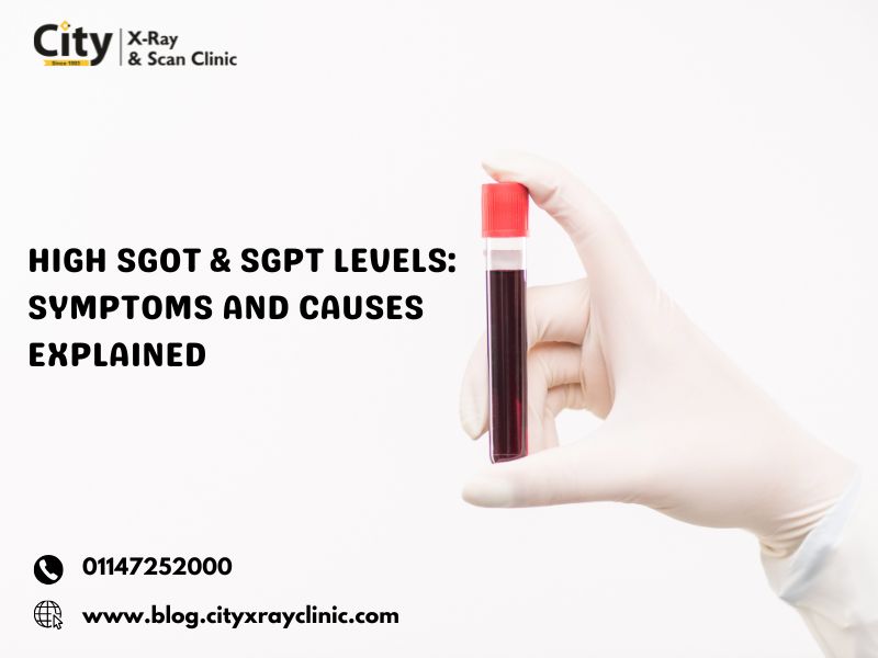 High SGOT  SGPT Levels Symptoms and Causes Explained - Delhi - Delhi ID1607862
