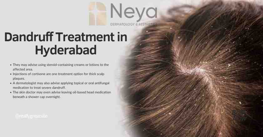 Dandruff Treatment in Hyderabad  - Andhra Pradesh - Hyderabad ID1520654