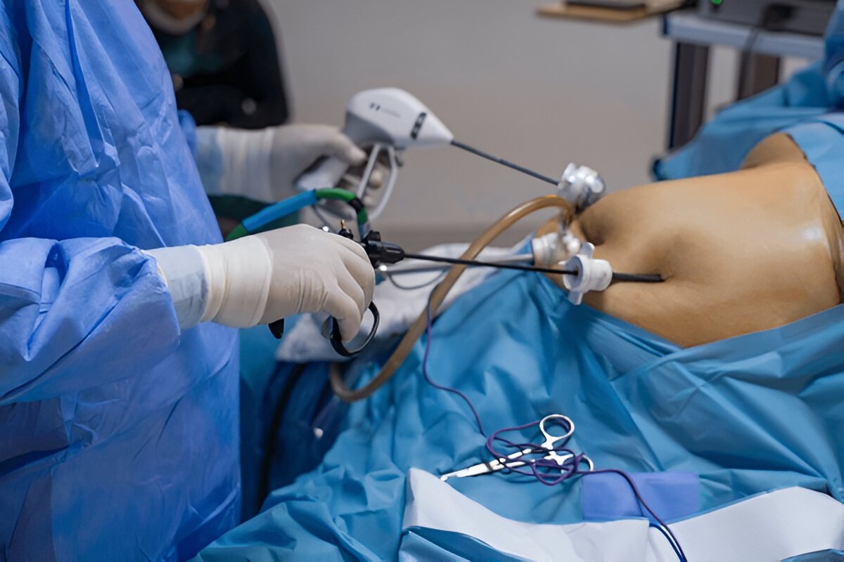 Minimally Invasive Bypass Surgery  Advanced Heart Treatme - Karnataka - Bangalore ID1616749