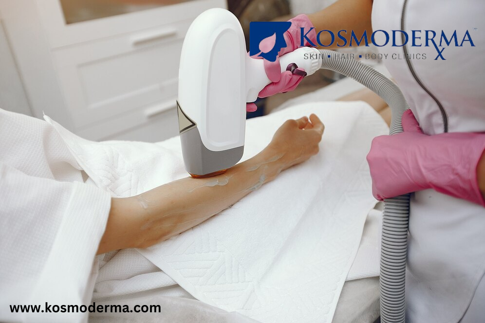 Electrolysis Hair Removal in Bangalore  Kosmoderma Skin and - Karnataka - Bangalore ID1599180