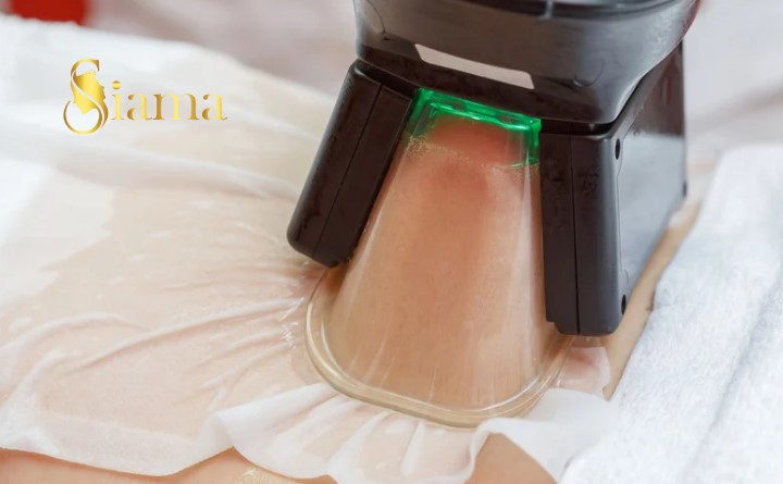 Cryolipolysis Fat Freezing In At Home in Ghaziabad - Uttar Pradesh - Noida ID1613708 3