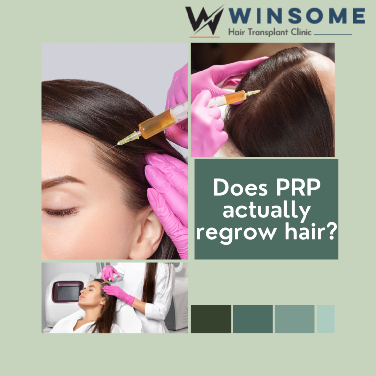 Does PRP Actually Regrow Hair? - Uttar Pradesh - Noida ID1601942