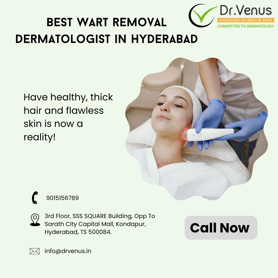 Best wart removal dermatologist in Hyderabad - Andhra Pradesh - Hyderabad ID1543072