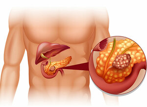 Expert Liver and Pancreas Specialist in Ludhiana - Punjab - Ludhiana ID1596714