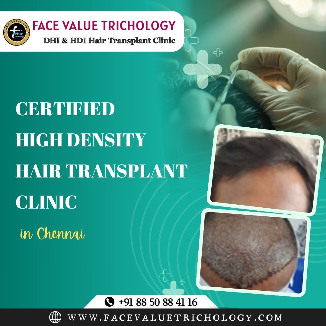 High Density Hair Transplant Clinic in Chennai - Tamil Nadu - Chennai ID1595581