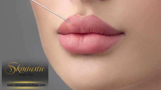 Redefine Your Smile with Lip Fillers Treatment - California - Riverside ID1555482