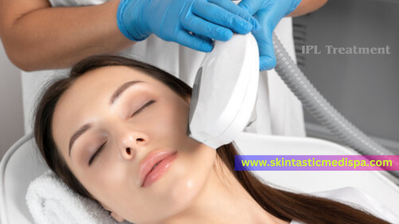 IPL Treatment for Revitalize Your Skin - California - Riverside ID1545464