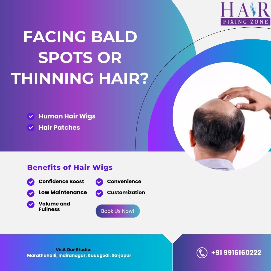FACING BALD SPOTS OR THINNING HAIR? - Karnataka - Bangalore ID1558198