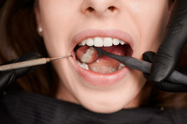 Root Canal Treatment in Newtown by Expert Dentist - West Bengal - Kolkata ID1614145