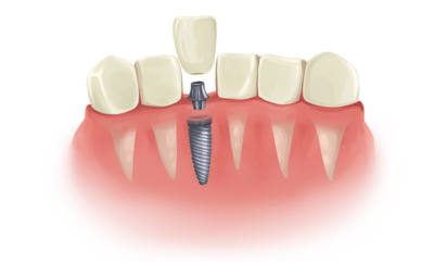 McClane Dentistry - Florida - West Palm Beach ID1601383 2
