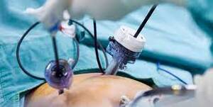 Best Hospital for Laparoscopic Surgery in Kolkata - West Bengal - Kolkata ID1592120