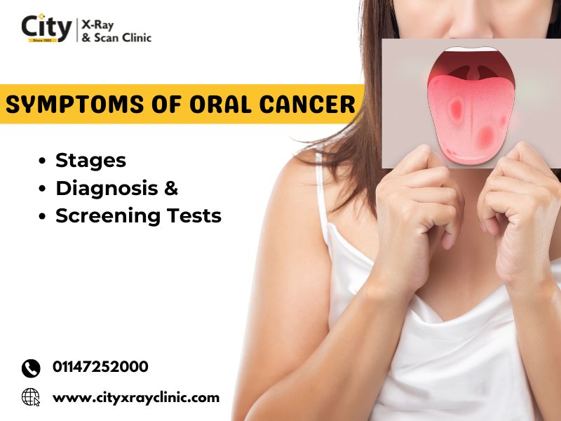 Symptoms of Oral Cancer Stages Diagnosis  Screening Tests - Delhi - Delhi ID1610962