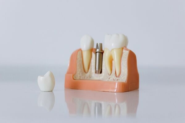 Top Dental Implant Clinic in Newtown  Trusted Specialists - West Bengal - Kolkata ID1610319