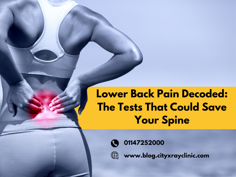 Causes of Lower Back Pain Common Reasons Symptoms  Diagno - Delhi - Delhi ID1610586