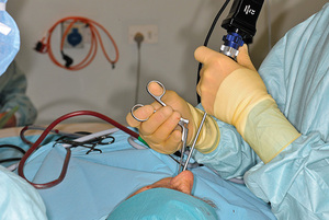 Expert Laparoscopic Surgeon in Kolkata  Dr Purnendu Roy - West Bengal - Kolkata ID1599101