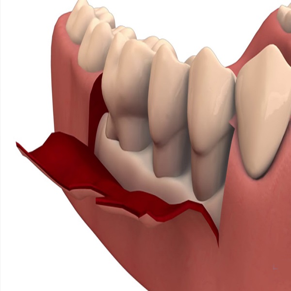 Best Dental surgery clinic in Dubai UAE - California - Bakersfield ID1595044