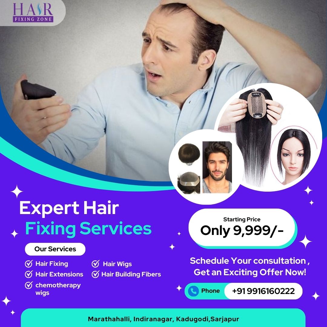 Overcoming Baldness with Hair Fixing Solutions! - Karnataka - Bangalore ID1556928