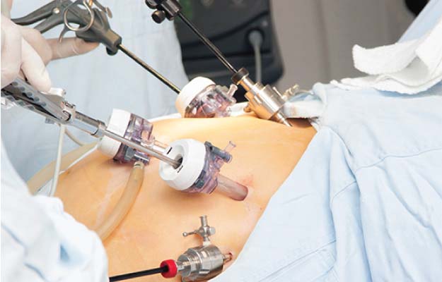 Best Laparoscopic Surgeon in Kolkata - West Bengal - Kolkata ID1591248