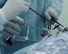 Top Hospital for Laparoscopic Surgery in Kolkata - West Bengal - Kolkata ID1597140