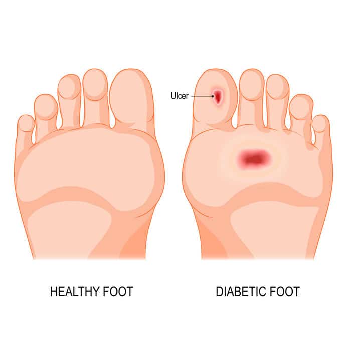 Advanced Diabetic Wound Care NYC  Oleg Karpenko Podiatry PC - New York - Brooklyn ID1605039 3