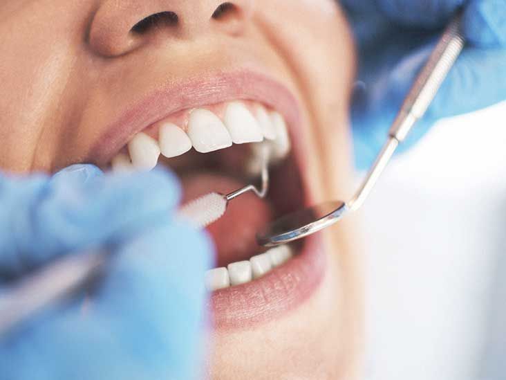 Dental Veneers - Maharashtra - Pune ID1556476 1