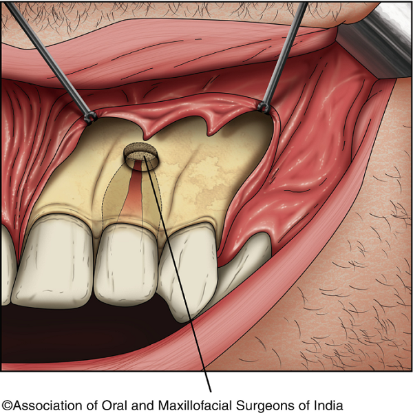 Best Endodontic surgery clinic in Dubai UAE - District of Columbia - Washington DC ID1588680