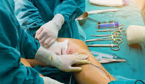 Best Knee Replacement Surgeon Doctor in Madurai - Tamil Nadu - Madurai ID1548303 2