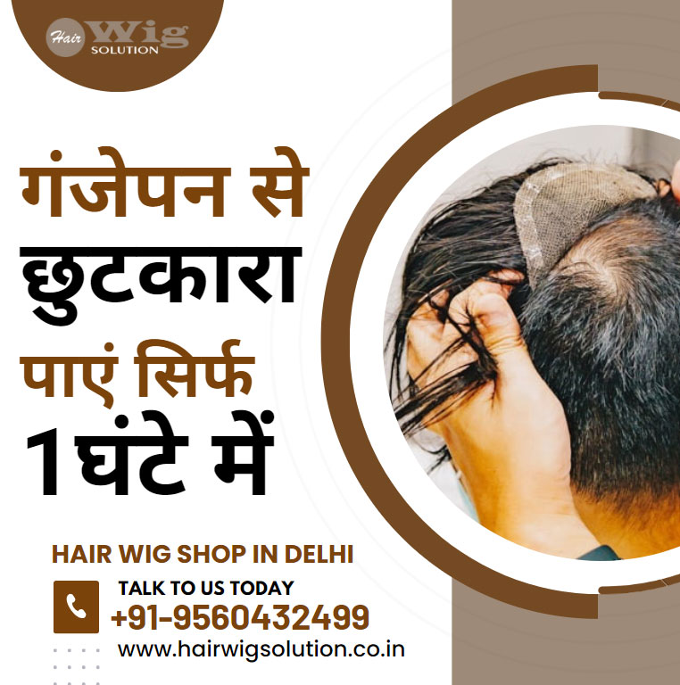 Hair Wig Shop in Delhi  Get rid of baldness in just 1 hour - Delhi - Delhi ID1544675