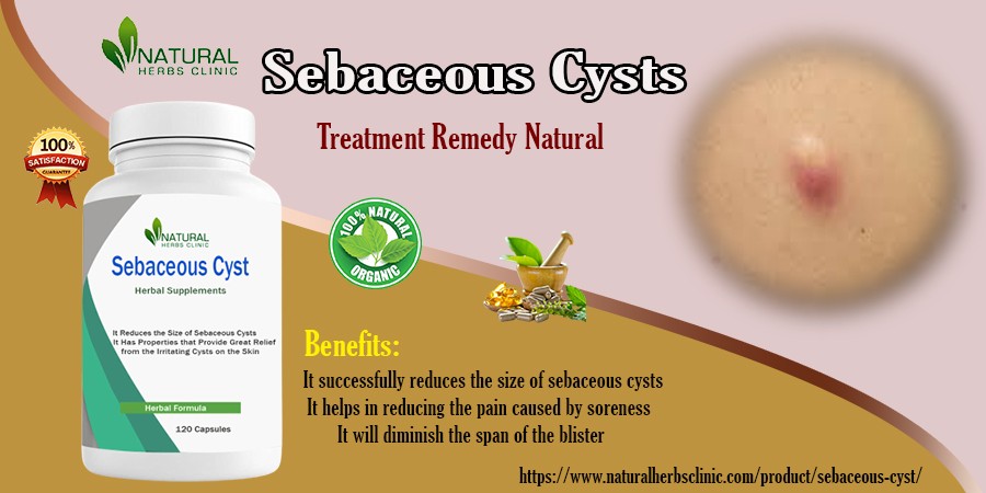 Home Removal of Sebaceous Cyst - Alaska - Anchorage ID1521363