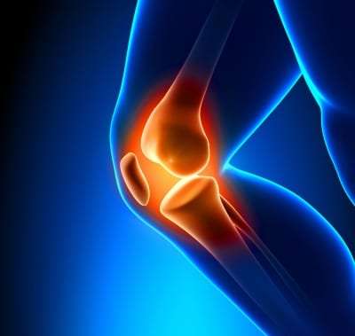 Comfoknee Knee Pain Relief Without Surgery or Medication - New York - New York ID1614468