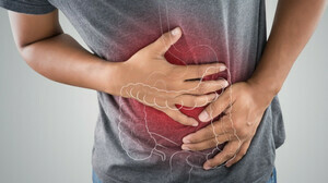Effective Inflammatory Bowel Disease IBD Treatment in Ahme - West Bengal - Kolkata ID1594626