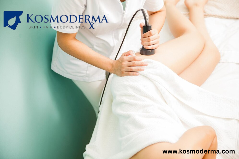  Effective Cellulite Treatment in Bangalore  Kosmoderma Ski - Karnataka - Bangalore ID1602893