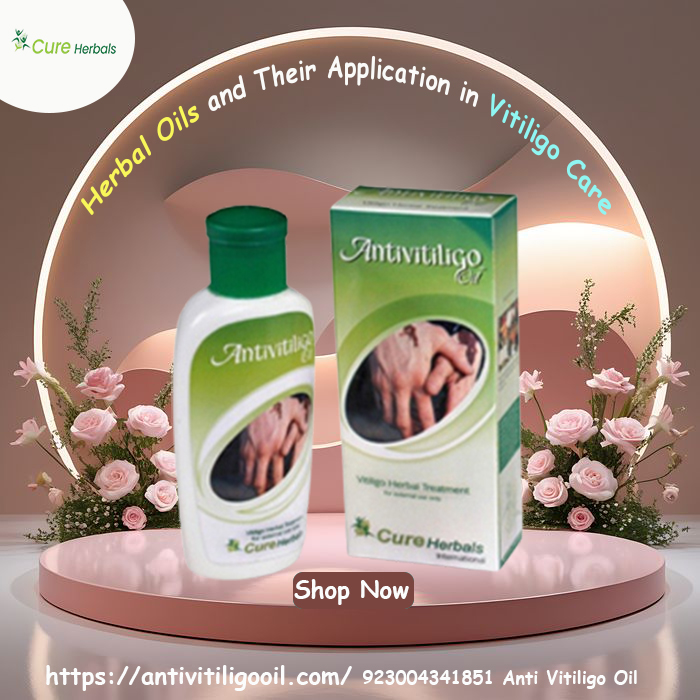 Shop Anti Vitiligo Oil for Natural Treatment of Vitiligo - Alabama - Birmingham ID1601721