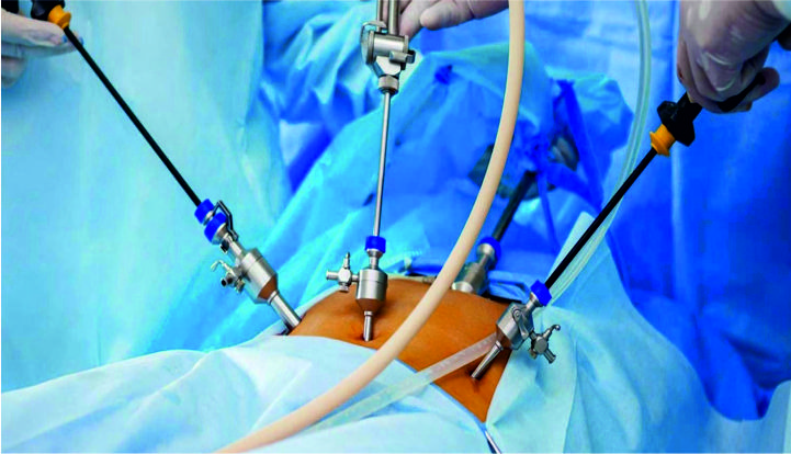 Best Laparoscopic Surgery Hospital in Kolkata - West Bengal - Kolkata ID1598859
