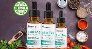 Is Treme Skin Tag Remover safe to use at home? - California - Bakersfield ID1587939