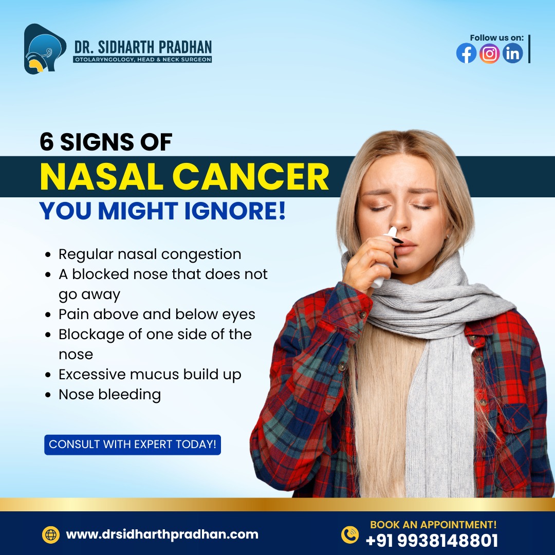 Nasal Cancer Treatment - Orissa - Bhubaneswar ID1603360