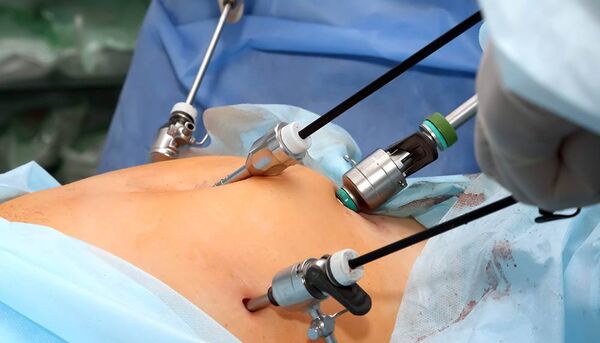 Expert Laparoscopic Surgeon in Ahmedabad  Dr Jigar Patel - Gujarat - Ahmedabad ID1611819