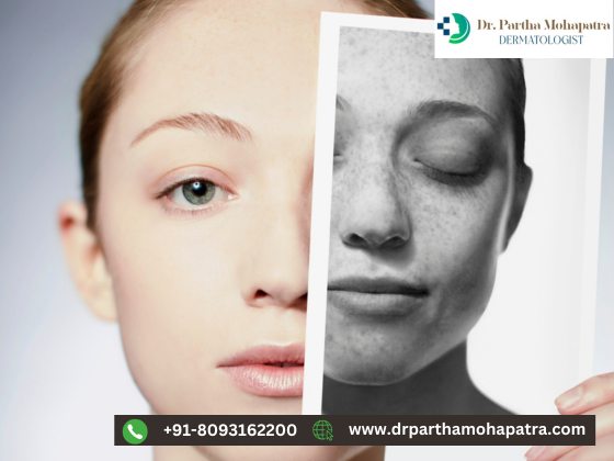 Dermatology in Bhubaneswar  Dr Partha Mohapatra - Orissa - Bhubaneswar ID1524256