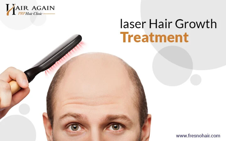 Laser Hair Replacement Therapy - California - Fresno ID1540651