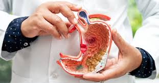 Expert Intestinal Problems Doctor in Gujarat - Gujarat - Ahmedabad ID1616325