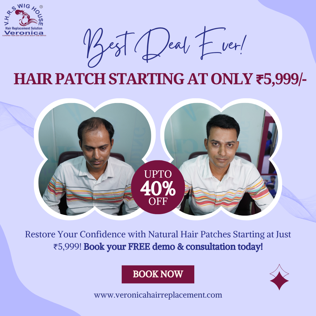 NonSurgical Hair Replacement  Baldness Solutions in Delhi - Delhi - Delhi ID1589008 1