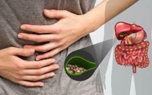Expert Gallbladder Stone Surgery at Genesis Hospital Kolkat - West Bengal - Kolkata ID1598444
