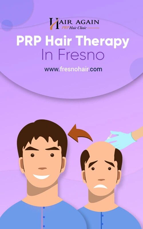 PRP Hair Therapy Fresno - California - Fresno ID1541899 2