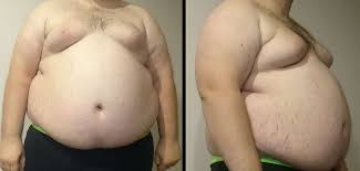 Join the 100 KG Weight Loss Plan Today - Maharashtra - Navi Mumbai ID1606200