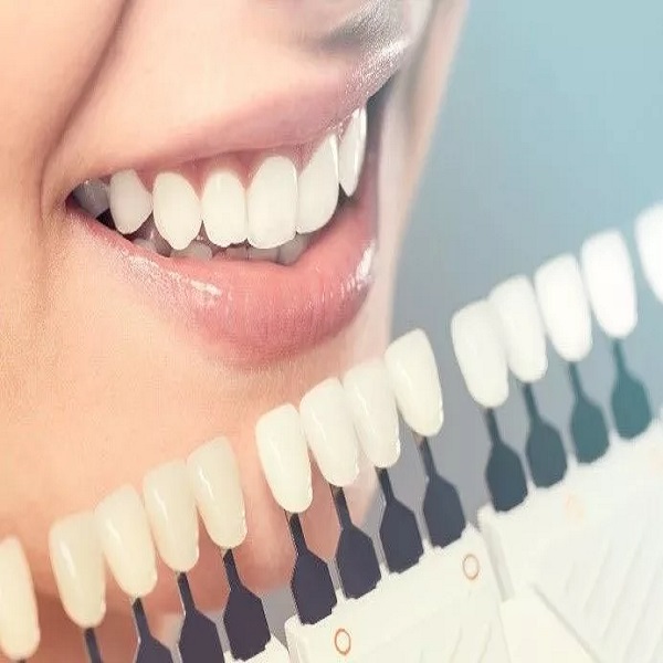 Best Cosmetic dentistry clinic in Dubai UAE - Connecticut - Stamford ID1591427