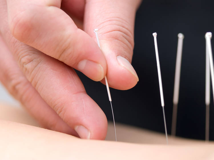 Acupuncture Therapy NYC - New York - New York ID1558234