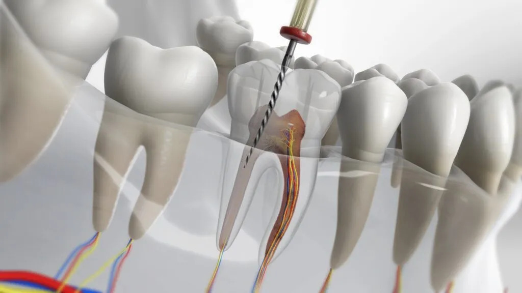 Dental Clinic  Bangalore  Best Dental Care  Discover Your - Karnataka - Bangalore ID1593914 3