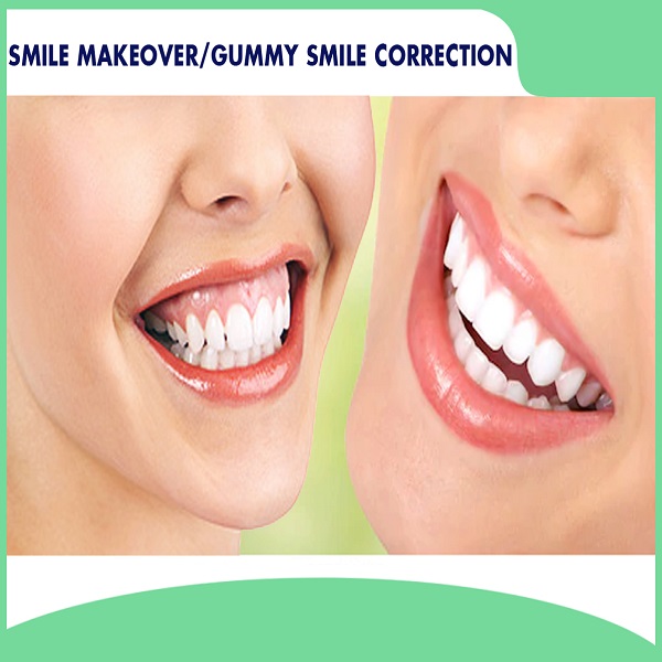 Best Smile Makeover clinic in Dubai UAE - Arizona - Gilbert ID1594527