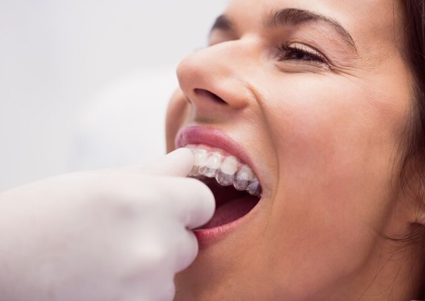 Looking for a Dentist in Manor? Weve Got You Covered! - Texas - Austin ID1587293