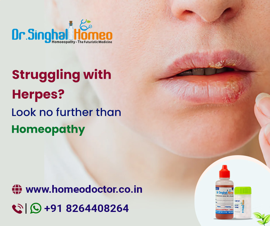 Struggling with Herpes? Look no further than Homeopathy - Chandigarh - Chandigarh ID1518474